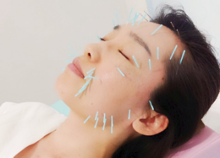 女性のキレイを内側から引き出す痩身エステ・リンパマッサージ・美容鍼